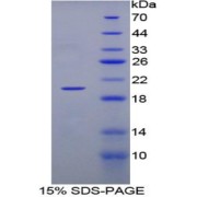 SDS-PAGE analysis of Rabbit TNFb Protein.