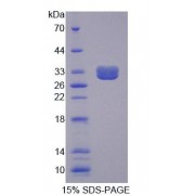 SDS-PAGE analysis of Mouse TNFRSF1B Protein.