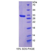 SDS-PAGE analysis of Rat VCAM1 Protein.