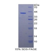 SDS-PAGE analysis of Rabbit VCAM1 Protein.