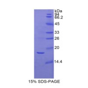 SDS-PAGE analysis of Mouse VCAM1 Protein.