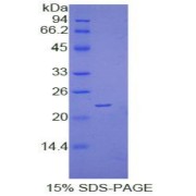 SDS-PAGE analysis of Human VEGFB Protein.