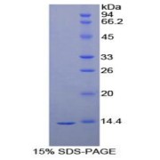 SDS-PAGE analysis of Human VEGFD Protein.