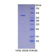 SDS-PAGE analysis of Mouse VEGFR3 Protein.