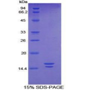 SDS-PAGE analysis of Human VIP Protein.