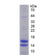 SDS-PAGE analysis of Rat VIP Protein.