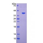 SDS-PAGE analysis of recombinant Human Versican Protein.