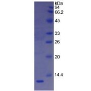 SDS-PAGE analysis of Human Vitronectin Protein.