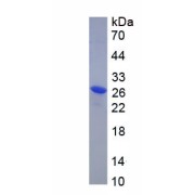 SDS-PAGE analysis of recombinant Human V-Ral Simian Leukemia Viral Oncogene Homolog A (RALA) Protein.