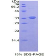 SDS-PAGE analysis of Mouse RELB Protein.