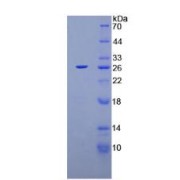 SDS-PAGE analysis of Rat XPC Protein.