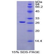 SDS-PAGE analysis of Rat XRCC6 Protein.