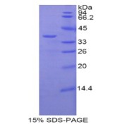 SDS-PAGE analysis of Mouse zAP70 Protein.