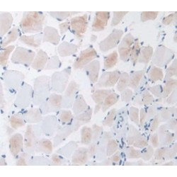 Furin (FURIN) Antibody