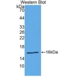 Renin (REN) Antibody