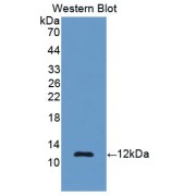 Western blot analysis of recombinant Rat REN Protein.