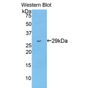 Western blot analysis of recombinant Human Titin Protein.