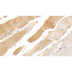 Titin (TTN) Antibody