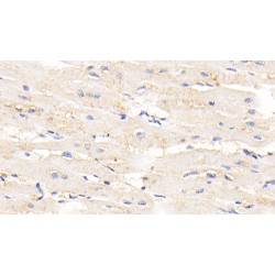 Titin (TTN) Antibody