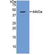 Western blot analysis of recombinant Rat Gastrin.