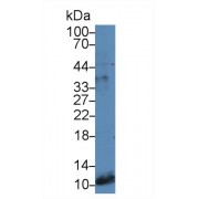 Western blot analysis of Rat Stomach lysate, using Human GT Antibody (5 µg/ml) and HRP-conjugated Goat Anti-Rabbit antibody (<a href="https://www.abbexa.com/index.php?route=product/search&amp;search=abx400043" target="_blank">abx400043</a>, 0.2 µg/ml).