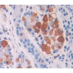 Gastrin (GT) Antibody