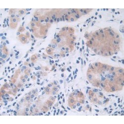 Leptin (LEP) Antibody