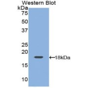 Western blot analysis of the recombinant protein.