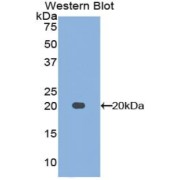 Western blot analysis of the recombinant protein.