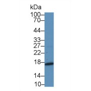 Western blot analysis of Rat Placenta lysate, using Rat MK Antibody (5 µg/ml) and HRP-conjugated Goat Anti-Rabbit antibody (<a href="https://www.abbexa.com/index.php?route=product/search&amp;search=abx400043" target="_blank">abx400043</a>, 0.2 µg/ml).