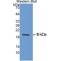 Midkine (MK) Antibody