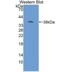 Moesin (MSN) Antibody