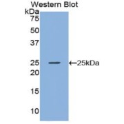 Western blot analysis of the recombinant protein.