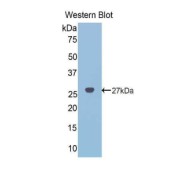 Western blot analysis of the recombinant protein.