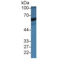 Albumin (ALB) Antibody