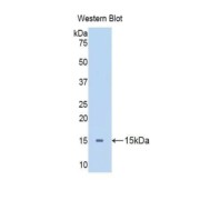 Western blot analysis of the recombinant protein.