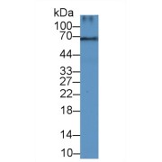 Western blot analysis of Rat Pancreas lysate, using Human DCN Antibody (3 µg/ml) and HRP-conjugated Goat Anti-Rabbit antibody (<a href="https://www.abbexa.com/index.php?route=product/search&amp;search=abx400043" target="_blank">abx400043</a>, 0.2 µg/ml).