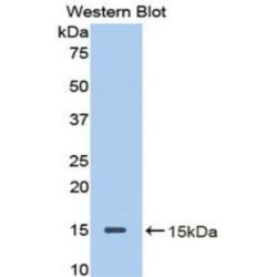 Decorin (DCN) Antibody