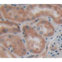 Fascin (FSCN) Antibody