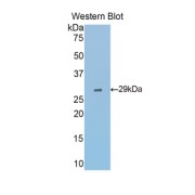 Western blot analysis of the recombinant protein.