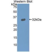 Western blot analysis of recombinant Cow GSN Protein.