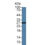 Western blot analysis of Cow Liver lysate, using Cow INS Antibody (1 µg/ml) and HRP-conjugated Goat Anti-Rabbit antibody (<a href="https://www.abbexa.com/index.php?route=product/search&amp;search=abx400043" target="_blank">abx400043</a>, 0.2 µg/ml).