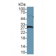 Western blot analysis of Human HeLa cell lysate, using Human LXN Antibody (1 µg/ml) and HRP-conjugated Goat Anti-Rabbit antibody (<a href="https://www.abbexa.com/index.php?route=product/search&amp;search=abx400043" target="_blank">abx400043</a>, 0.2 µg/ml).