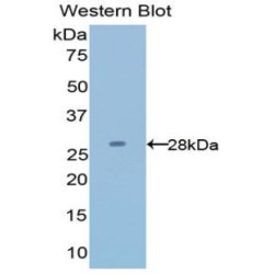 Latexin (LXN) Antibody