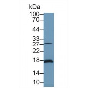Western blot analysis of Rat Cerebrum lysate, using Mouse LXN Antibody (1 µg/ml) and HRP-conjugated Goat Anti-Rabbit antibody (<a href="https://www.abbexa.com/index.php?route=product/search&amp;search=abx400043" target="_blank">abx400043</a>, 0.2 µg/ml).