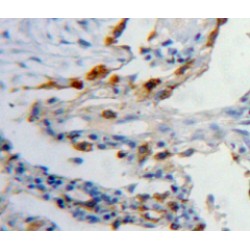 Latexin (LXN) Antibody