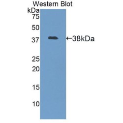 Lumican (LUM) Antibody