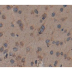 Lumican (LUM) Antibody