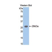 Western blot analysis of the recombinant protein.