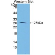 Western blot analysis of the recombinant protein.